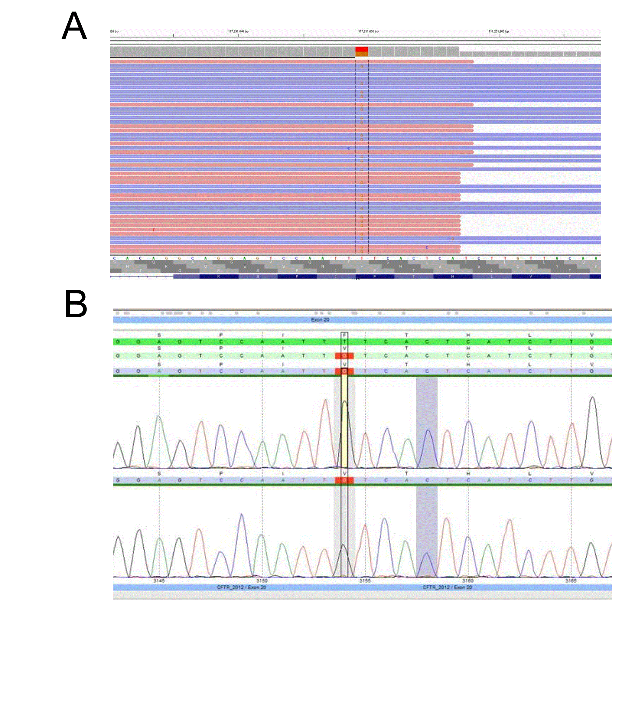 Figure 4: CFTR NGS assay accurately detects variants missed by Sanger sequencing due to allele-dropout